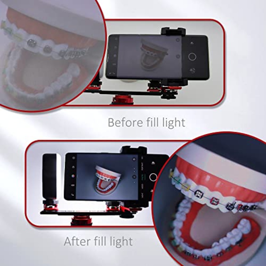 Bluetooth Dental Flash Light P - Photography Equipment บทวิจารณ์และราคา