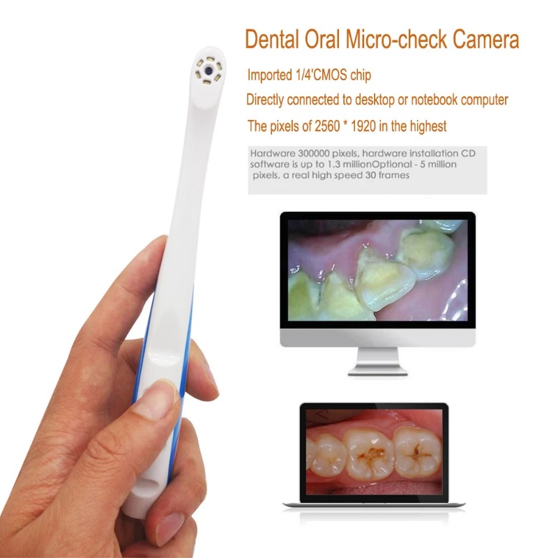 USB Dental Camera Wireless Int - Photography Equipment บทวิจารณ์และราคา