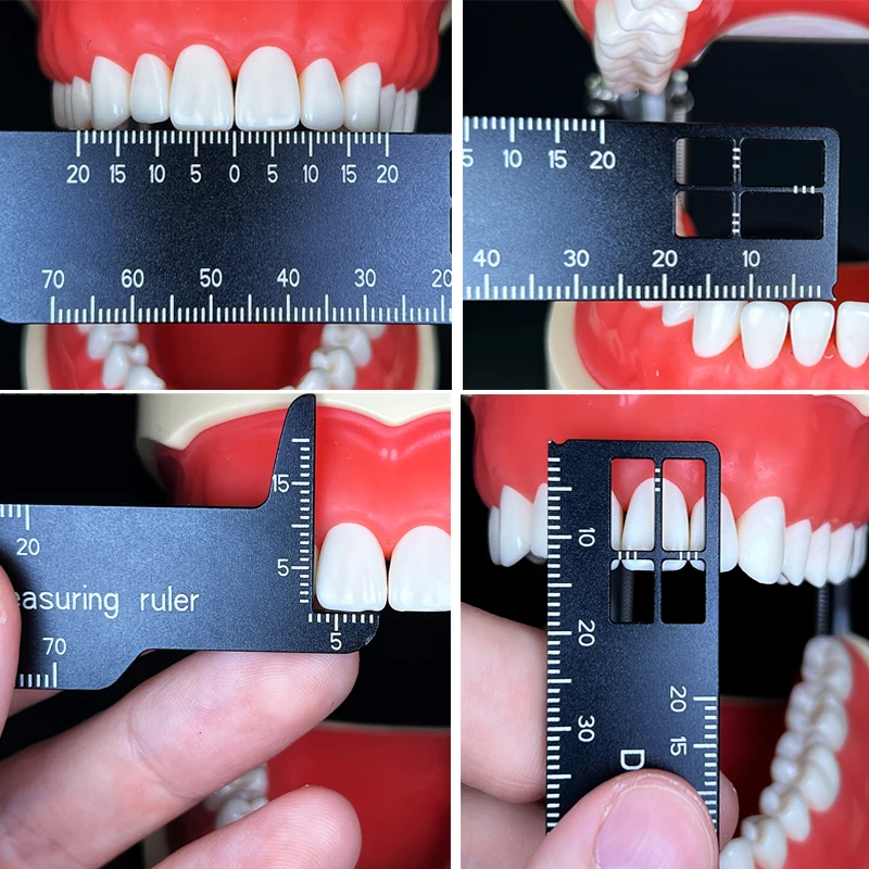 Autoclavable Dental Precision  - Photography Rules บทวิจารณ์และราคา