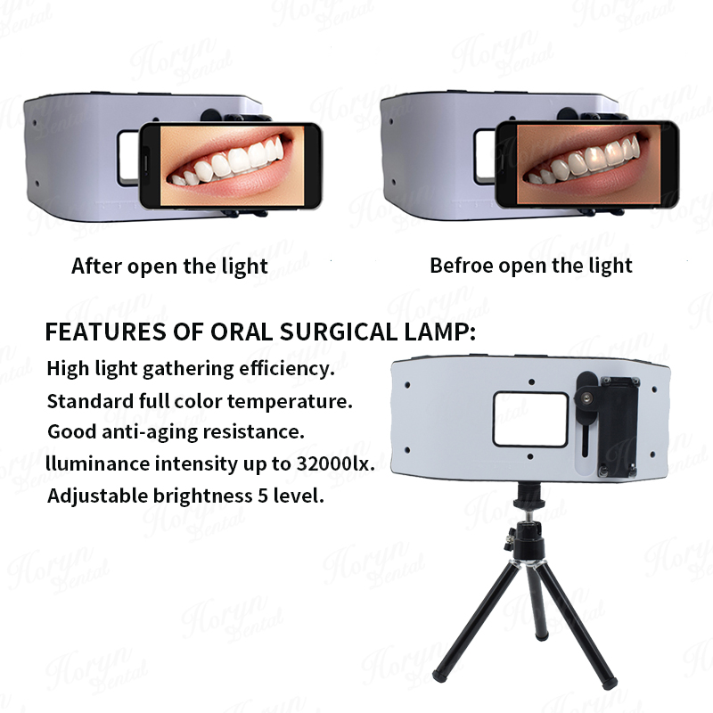 Dental Flash Light Photography - Photography Equipment บทวิจารณ์และราคา